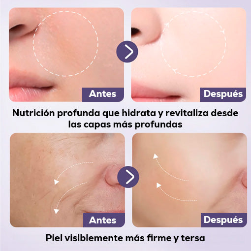 COMBO MASCARILLA RENOVADORA ANTIEDAD 🤩😱 ¡Parches colágeno + Retinol + Jabón Vitamina C!