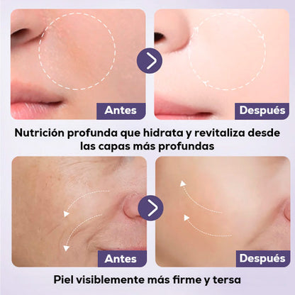 COMBO MASCARILLA RENOVADORA ANTIEDAD 🤩😱 ¡Parches colágeno + Retinol + Jabón Vitamina C!